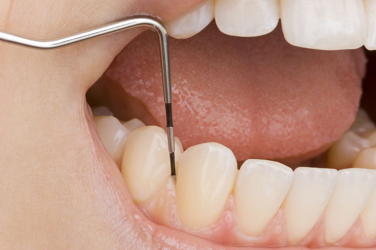 periodoncia-1 periodoncia-1