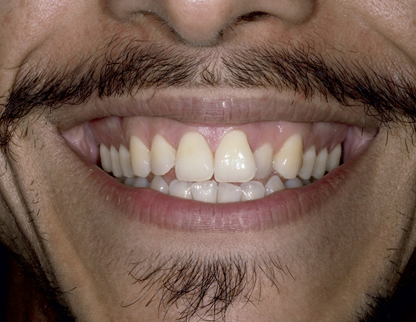 dossier-soludental-5147-horizontal.cdr dossier-soludental-5147-horizontal.cdr