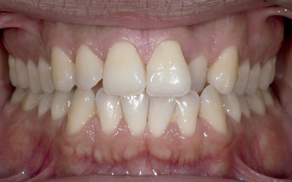 dossier-soludental-5147-horizontal.cdr dossier-soludental-5147-horizontal.cdr
