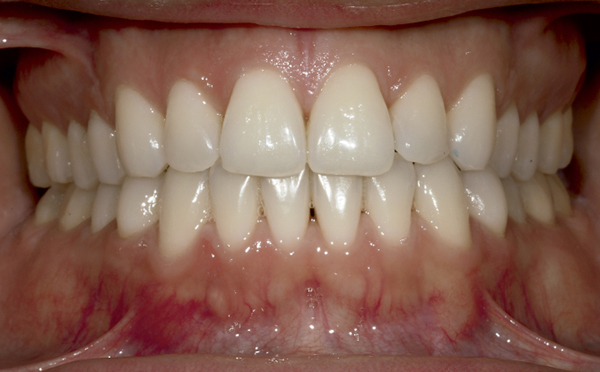 dossier-soludental-5147-horizontal.cdr dossier-soludental-5147-horizontal.cdr