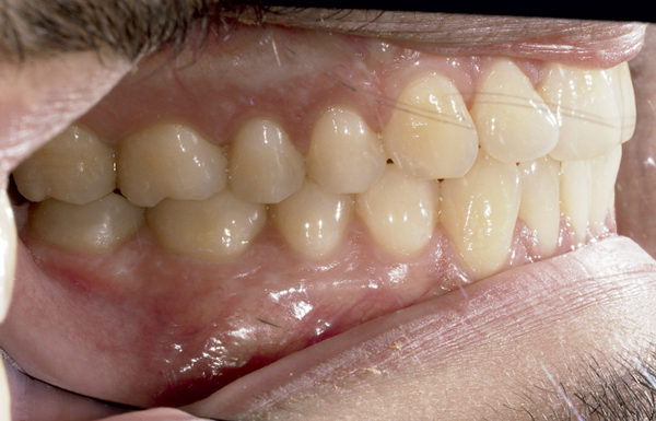 dossier-soludental-5147-horizontal.cdr dossier-soludental-5147-horizontal.cdr