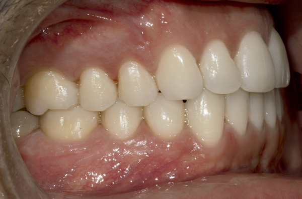 dossier-soludental-5147-horizontal.cdr dossier-soludental-5147-horizontal.cdr