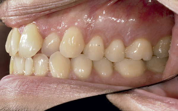 dossier-soludental-5147-horizontal.cdr dossier-soludental-5147-horizontal.cdr