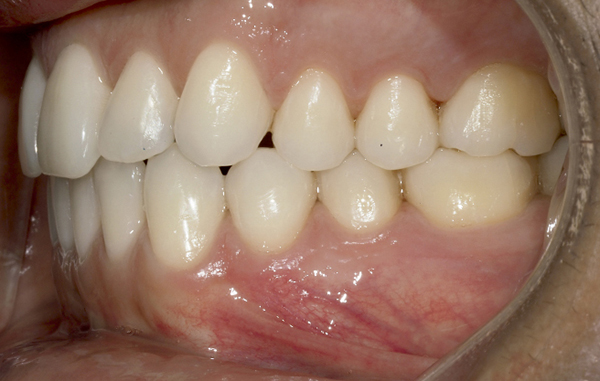 dossier-soludental-5147-horizontal.cdr dossier-soludental-5147-horizontal.cdr