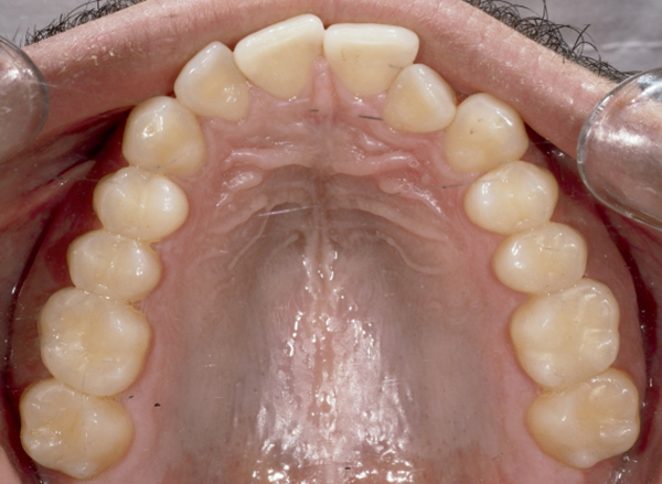 dossier-soludental-5147-horizontal.cdr dossier-soludental-5147-horizontal.cdr