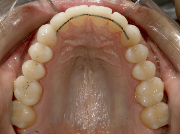 dossier-soludental-5147-horizontal.cdr dossier-soludental-5147-horizontal.cdr