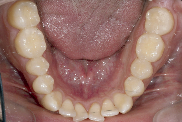 dossier-soludental-5147-horizontal.cdr dossier-soludental-5147-horizontal.cdr