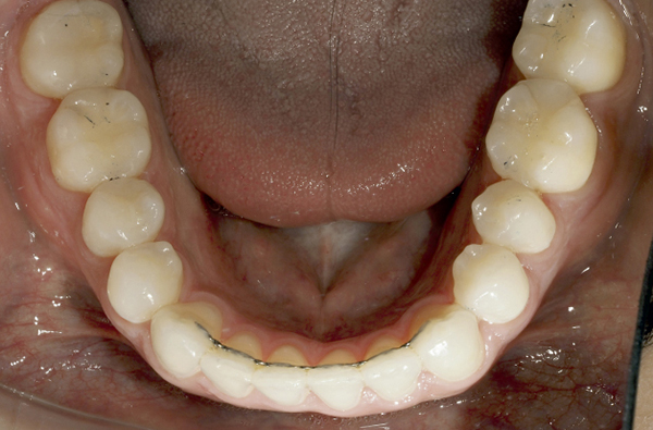 dossier-soludental-5147-horizontal.cdr dossier-soludental-5147-horizontal.cdr