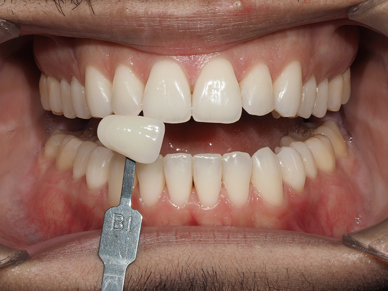 soludental soludental