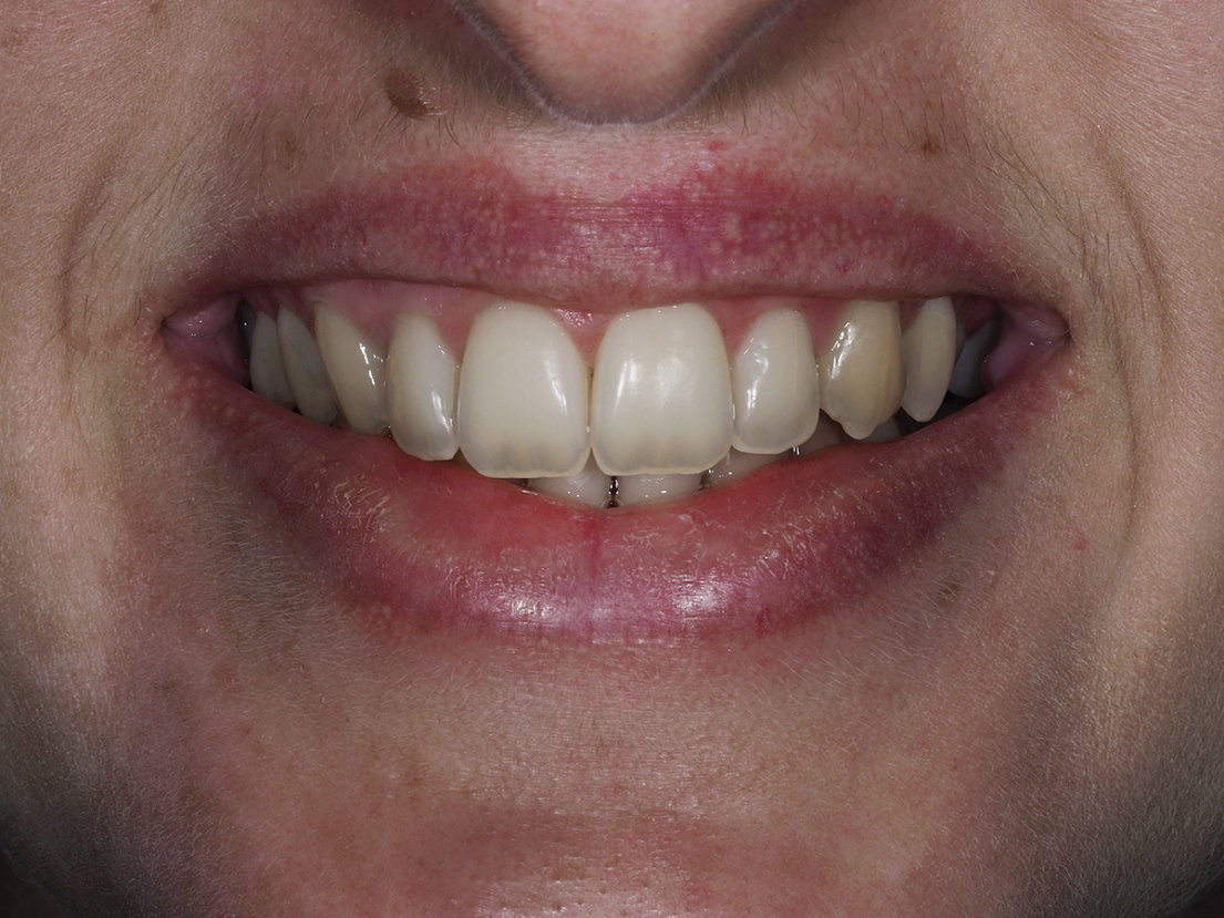 6074-ANTES (1) 6074-ANTES (1)