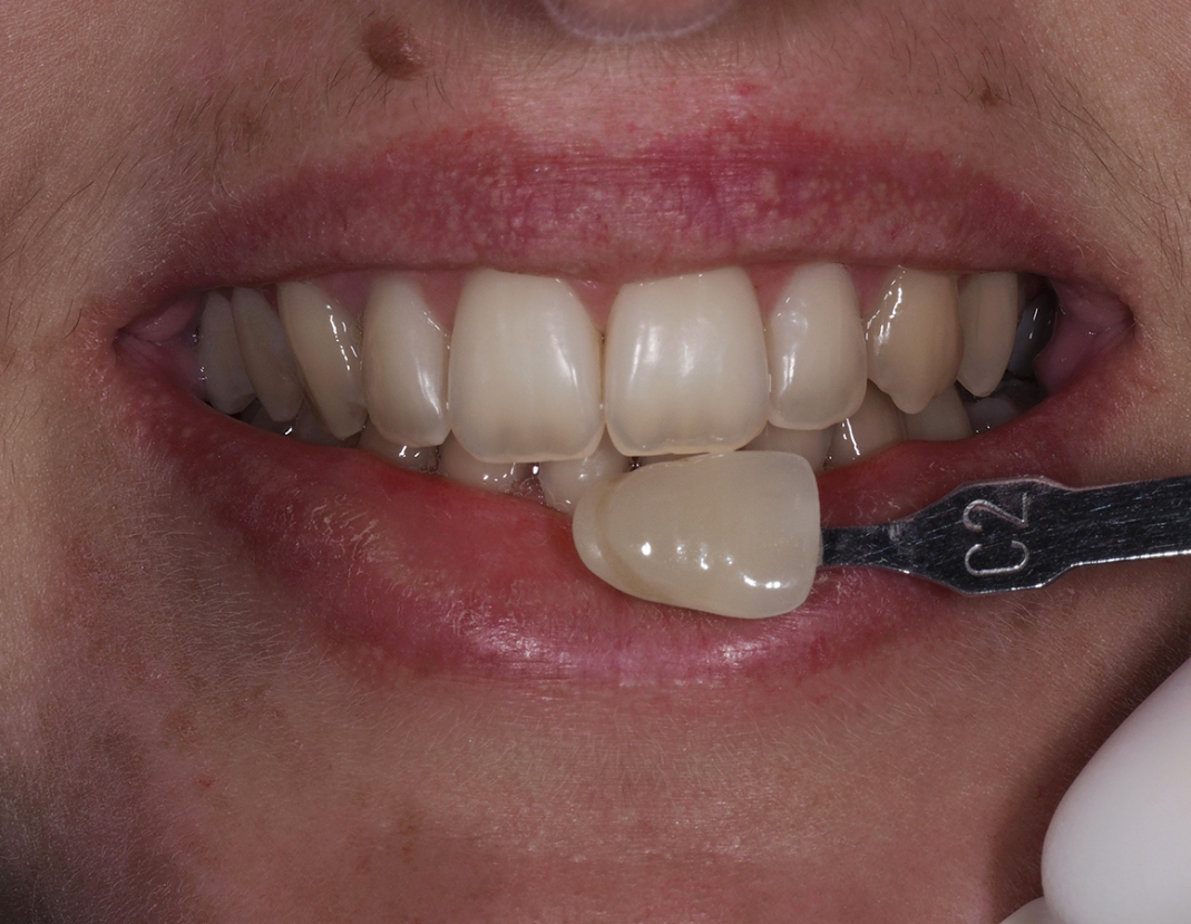 6074-ANTES 6074-ANTES