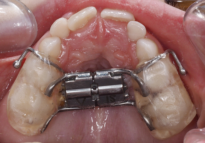 soludental soludental