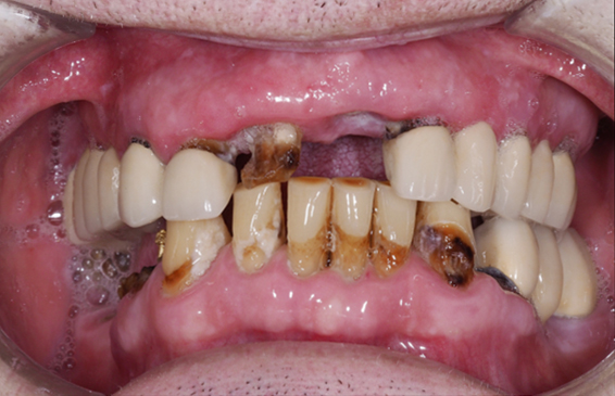 6623-ANTES 6623-ANTES