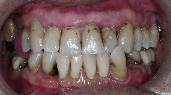 6780-ANTES 6780-ANTES