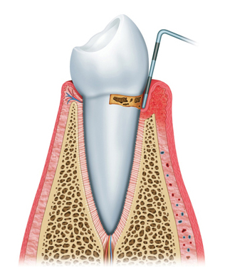 preiimplantitis (2) preiimplantitis (2)