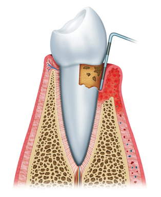 preiimplantitis (3) preiimplantitis (3)