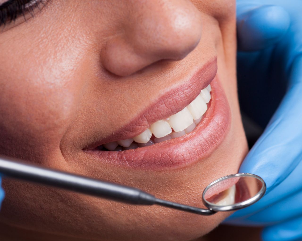 Odontología Conservadora en Santa Cruz de Tenerife