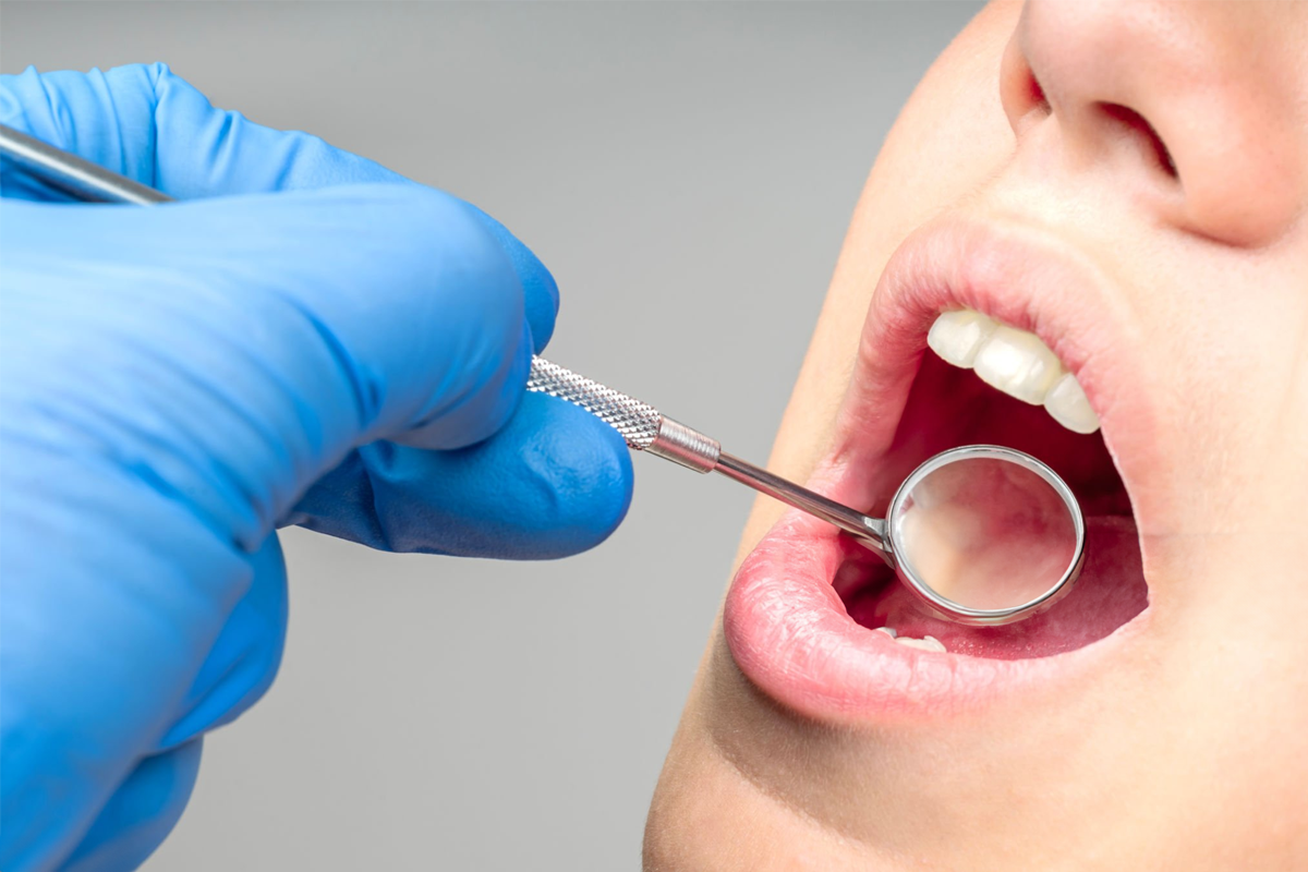 Periodoncia en Santa Cruz de Tenerife