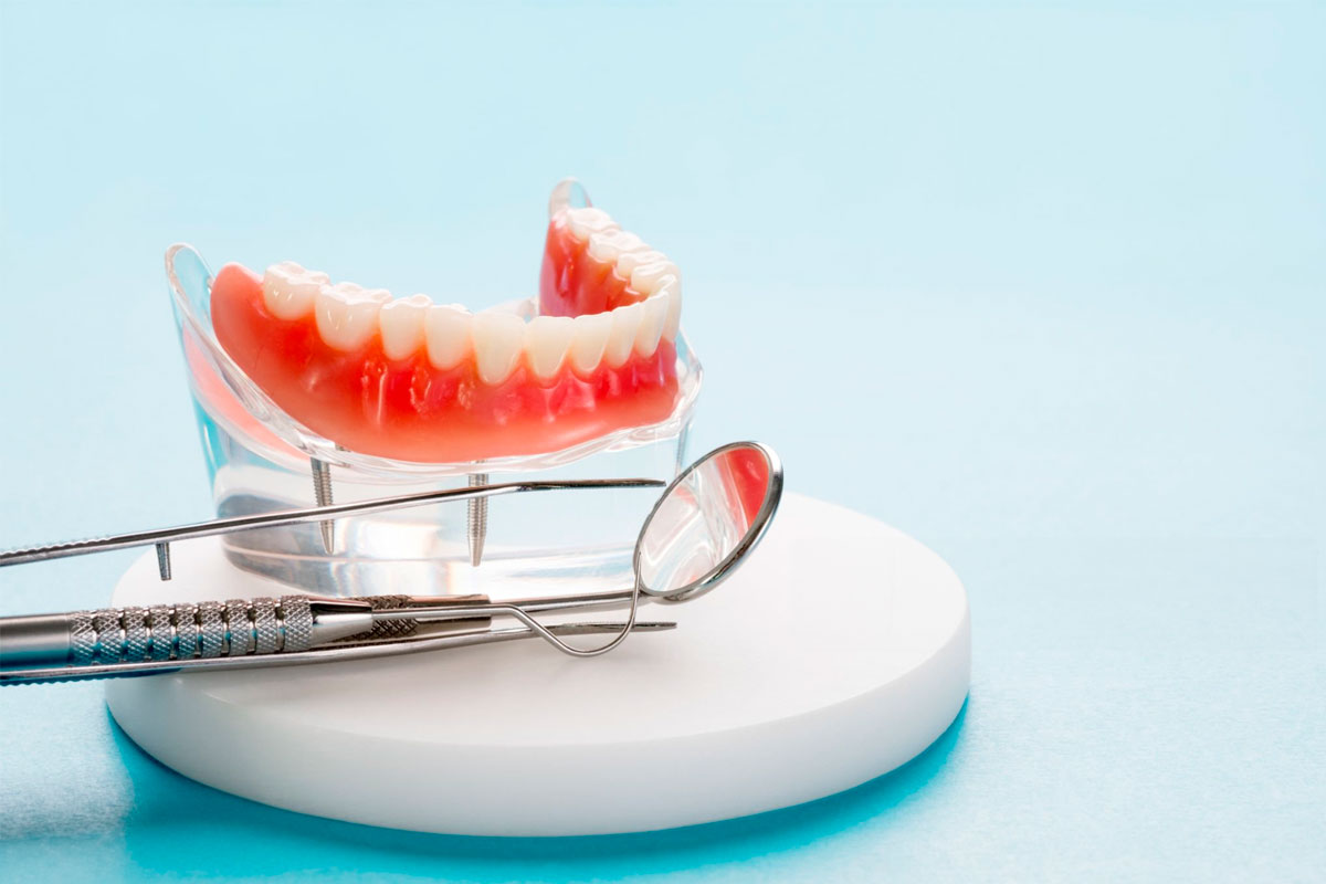 Prótesis dental en Santa Cruz de Tenerife