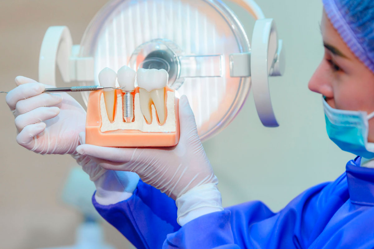 Implantes Dentales en Santa Cruz de Tenerife