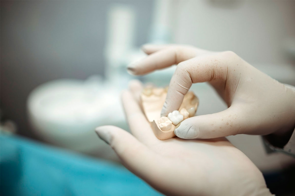 Reconstrucción dental Santa Cruz de Tenerife