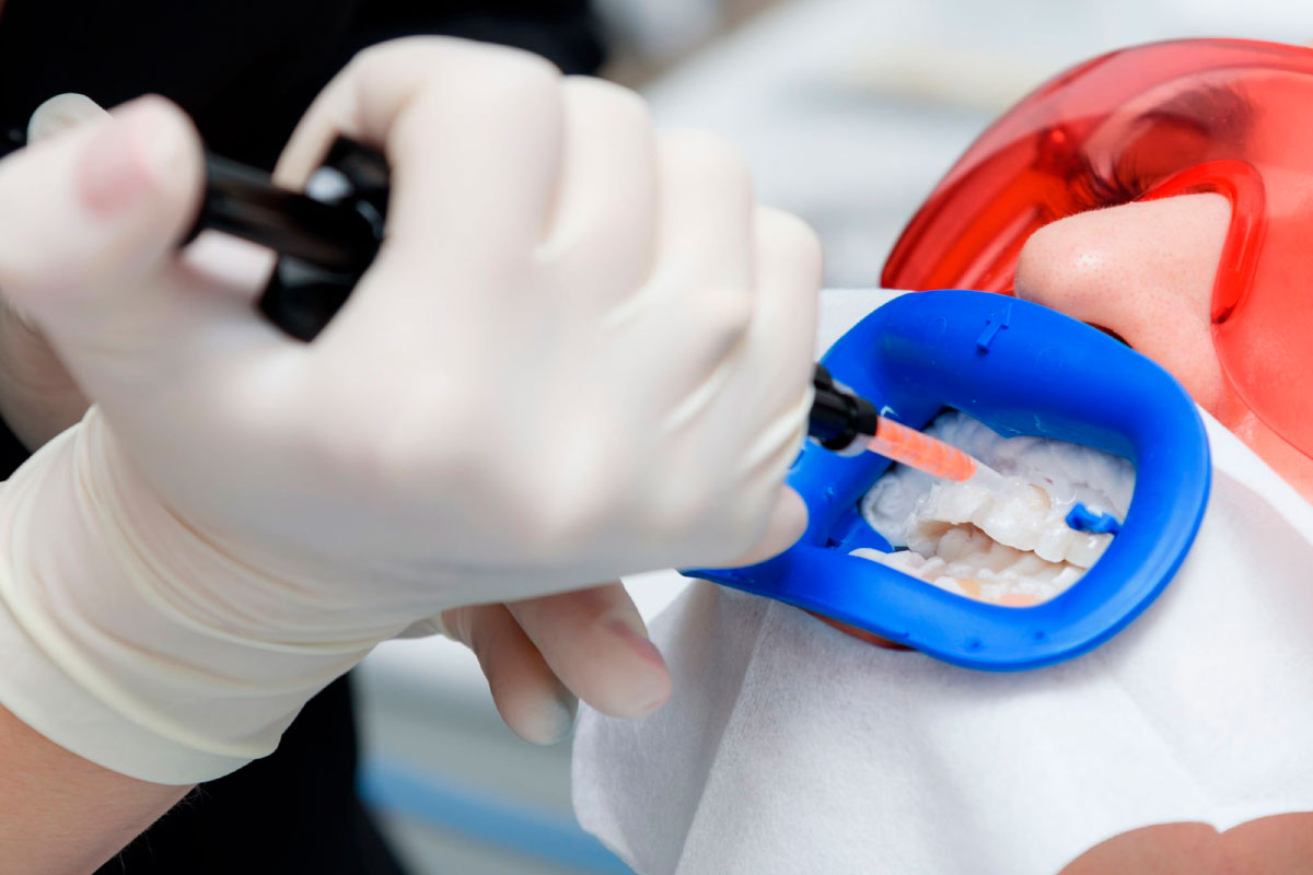 Plasma Rico en Factores de Crecimiento (PRGF)