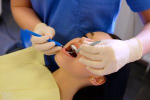 Empastes dentales