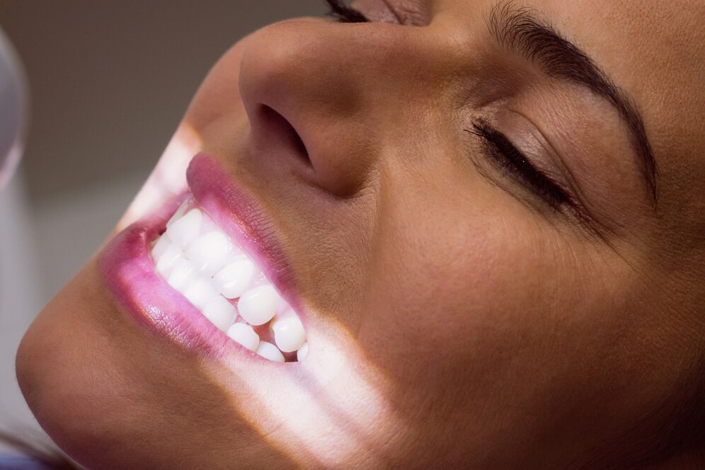 blanqueamiento dental