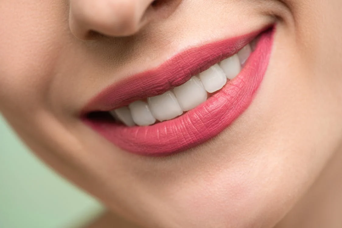 Diseño de sonrisa