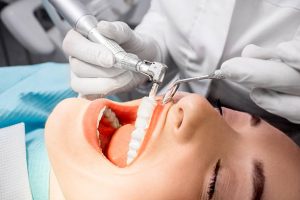 profilaxis dental